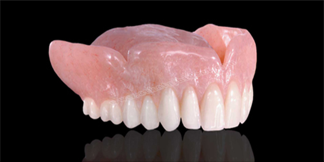 پروتز متحرک کامل دندان ها برای افرادی که همه دنداهایشان را کشیده اند