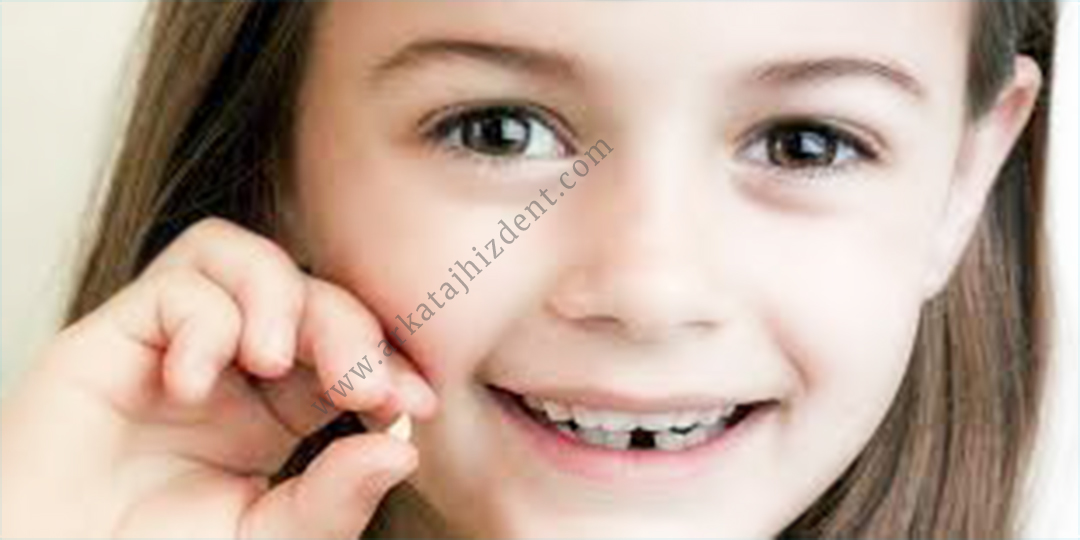 دندان لق کودکان