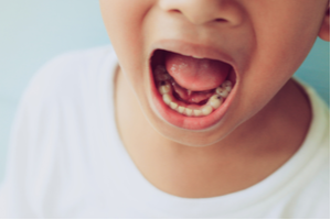 حفره دندان کودک